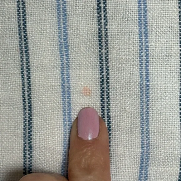 Reformation Linen Blue and White Striped Mini Dress - Picture 8 of 8